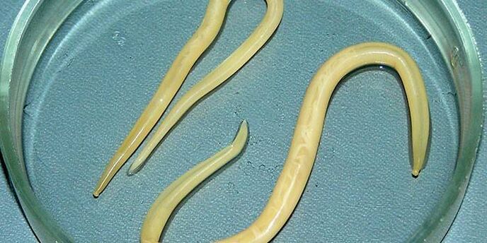 Vermes redondos humanos nunha placa de Petri - parasitan nas paredes do intestino delgado