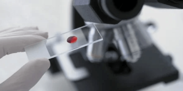 Mostra de sangue